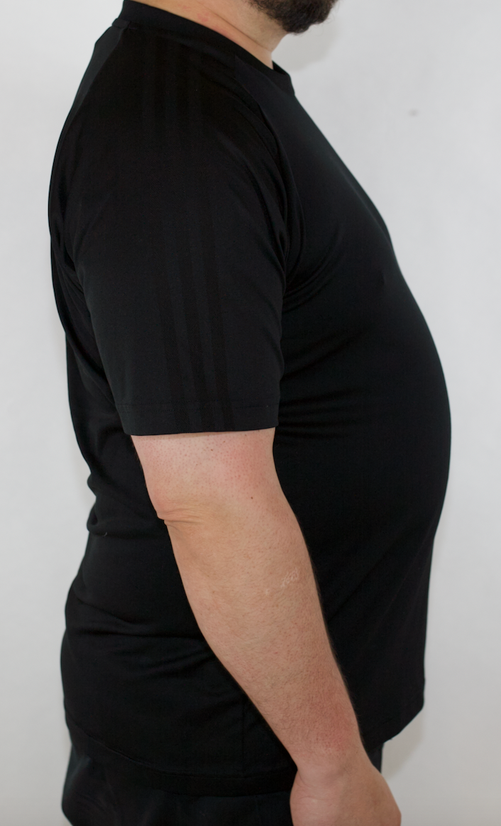 EXTREMELY RARE 2016 PALACE SKATEBOARD X ADIDAS T-SHIRT (XL)